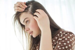 Sạch gàu hết ngứa với dầu gội cải thiện gàu ngứa da đầu cho nữ Santal 300