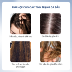 Dầu xả tóc gàu ngứa 200ml