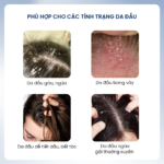 Combo sạch gàu ngứa hỗ trợ giảm da bong tróc [PHIÊN BẢN CŨ]