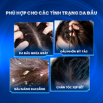 Combo làm sạch gàu mảng – CHO DA ĐẦU SẠCH VÀ CÂN BẰNG